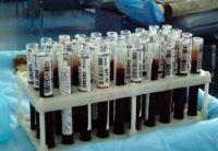 Sacche di sangue scaduto a Sassari