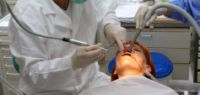 Una resina contro le carie: trapano addio dal dentista