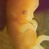 Spagna, il primo 'Sì' sull'aborto, in mattinata l'approvazione