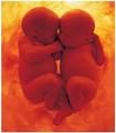 Usa, due gemelli, due padri diversi