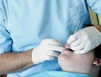 Scoperti 23 falsi dentisti con diplomi scaricati dal Web