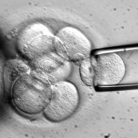 Staminali, Corte di giustizia Ue: no ai brevetti se si distruggono gli embrioni 
