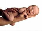 Cassazione: risarcimento a madre con nascituro malformato. I medici hanno il dovere di informare la madre sui rischi delle terapie che ella assume