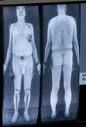 Body scanner, Pisani "Si accertino i rischi sulla salute dei passeggeri"